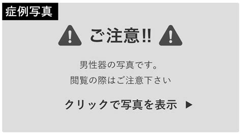 カリ高にする|【泌尿器科の医師が解説】亀頭を大きくする4つの方。